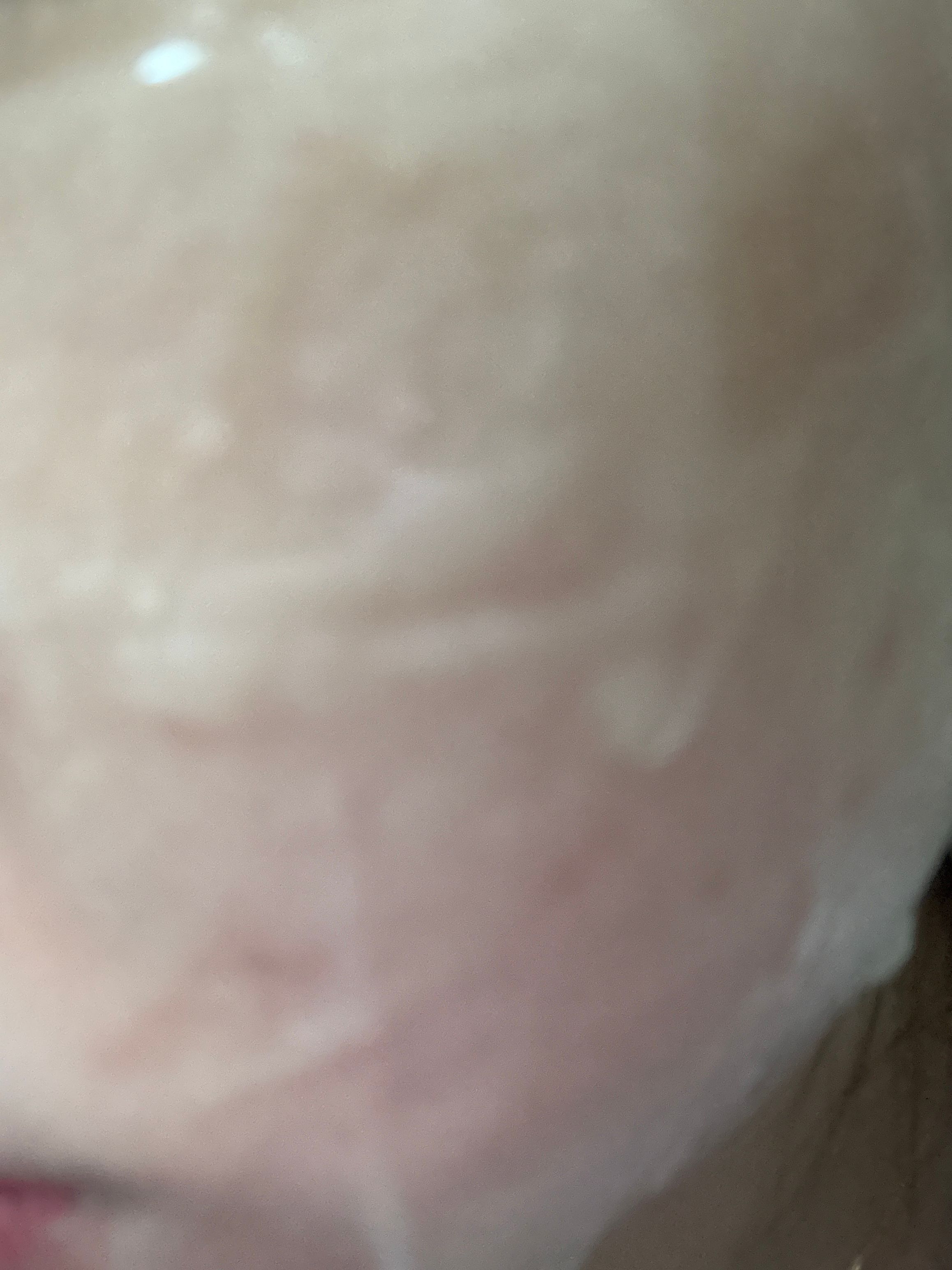 MEDIPEEL 玻尿酸玫瑰補水精華面膜 真實評價/用後感 byKwo***uen 1 MEDIPEEL 玻尿酸玫瑰補水精華面膜 真實評價/實測照片 byKwo***uen 1