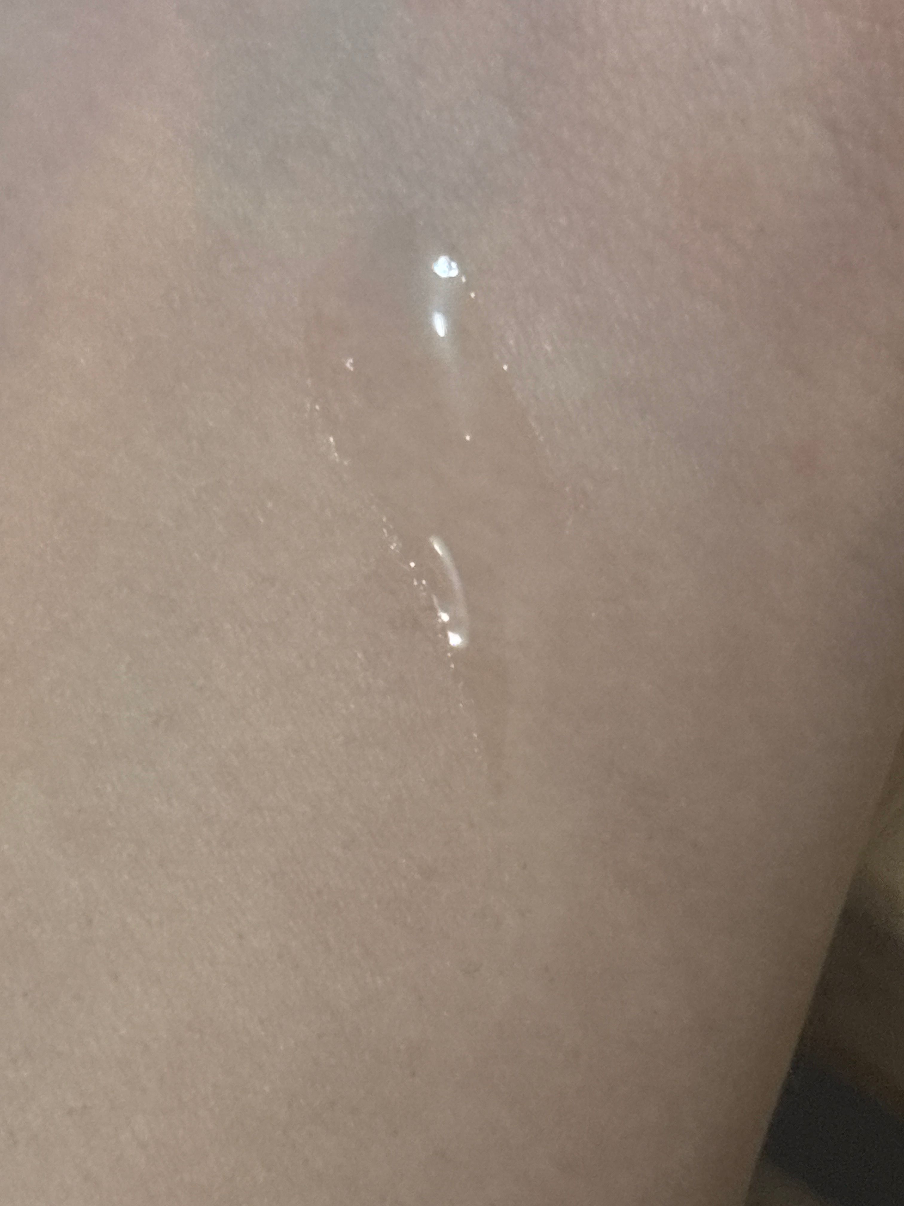 Clear Nose 暗瘡凝膠濃縮護理液 真實評價/實測照片 byC**. 1