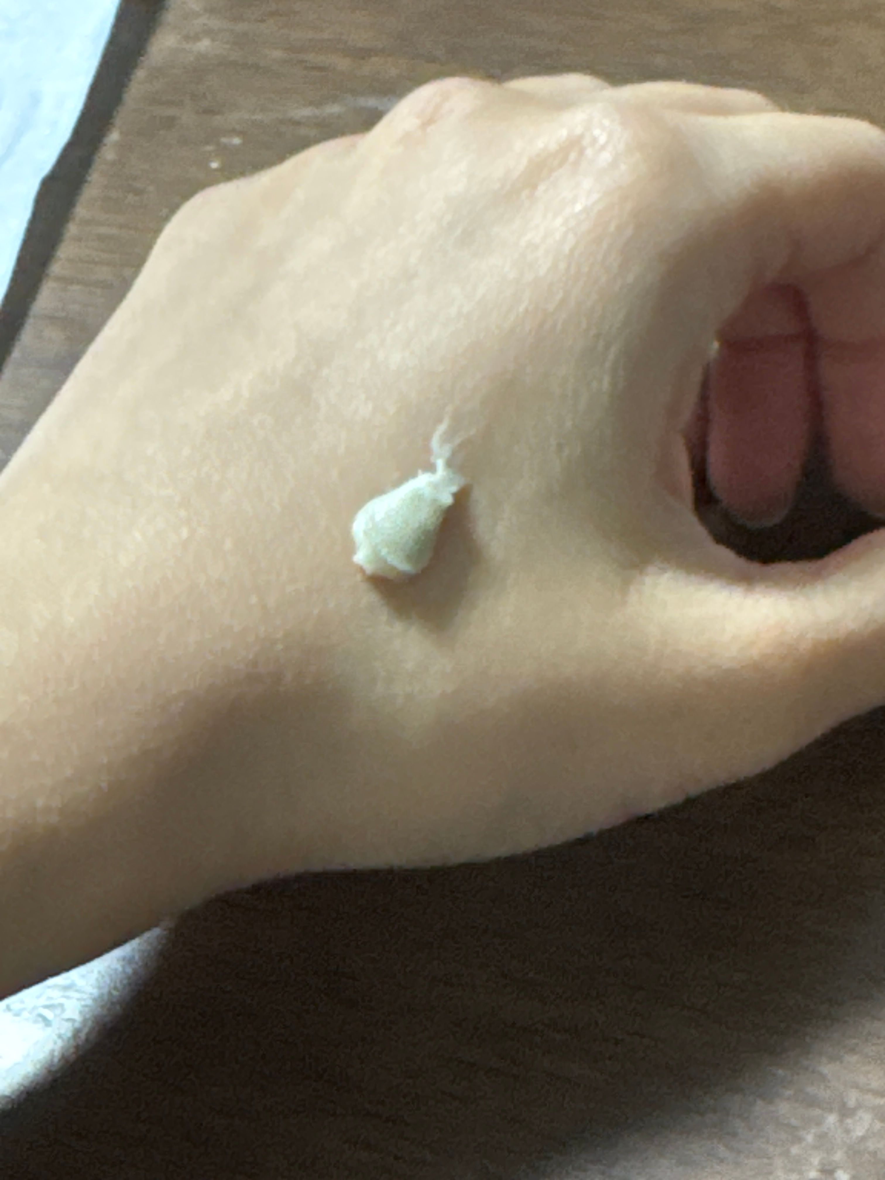 白兔牌 白兔牌暗瘡膏 真實評價/實測照片 byE*i 1