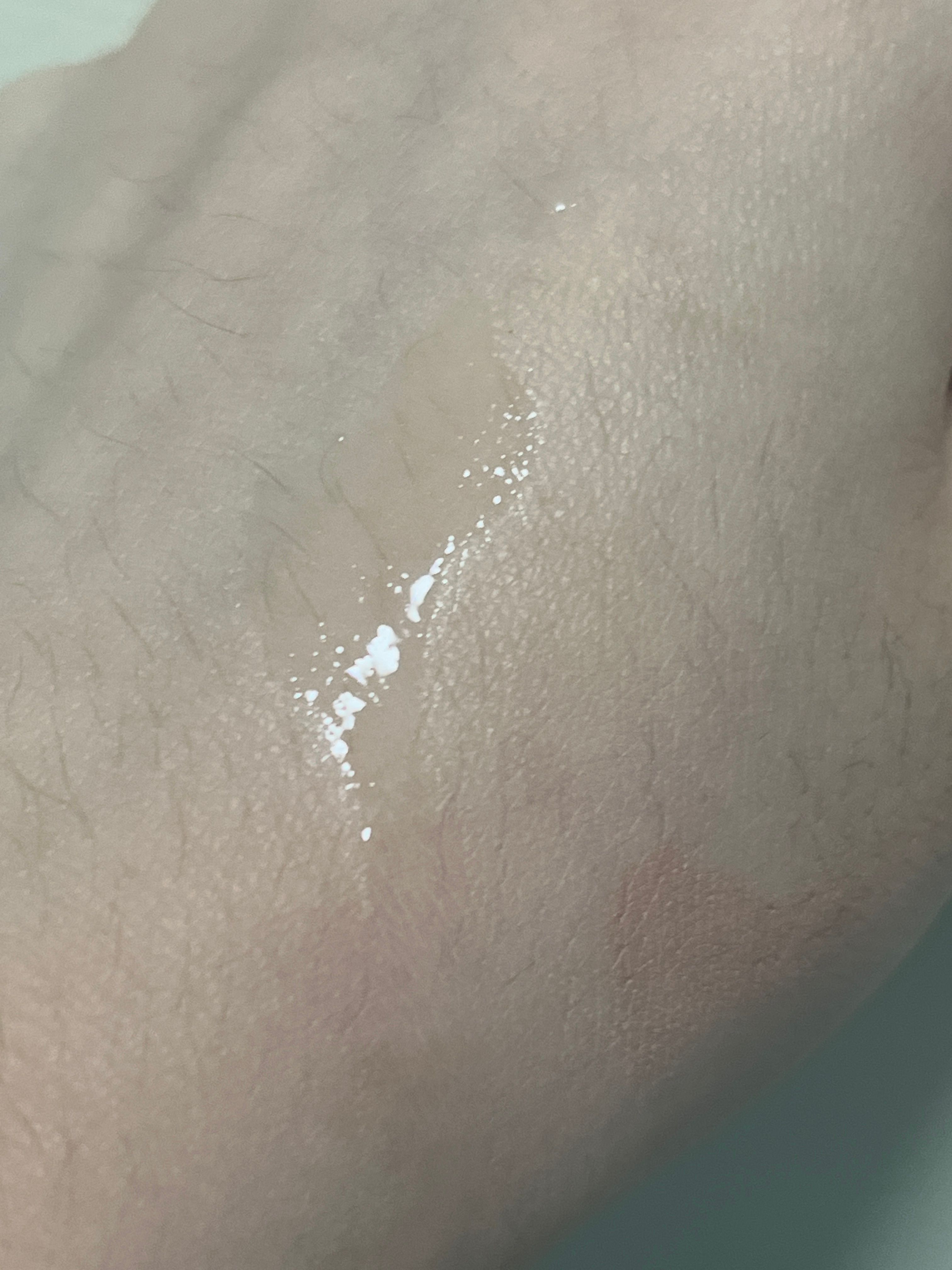 Ilso 黑頭粉刺導出液 真實評價/實測照片 by지*이 1