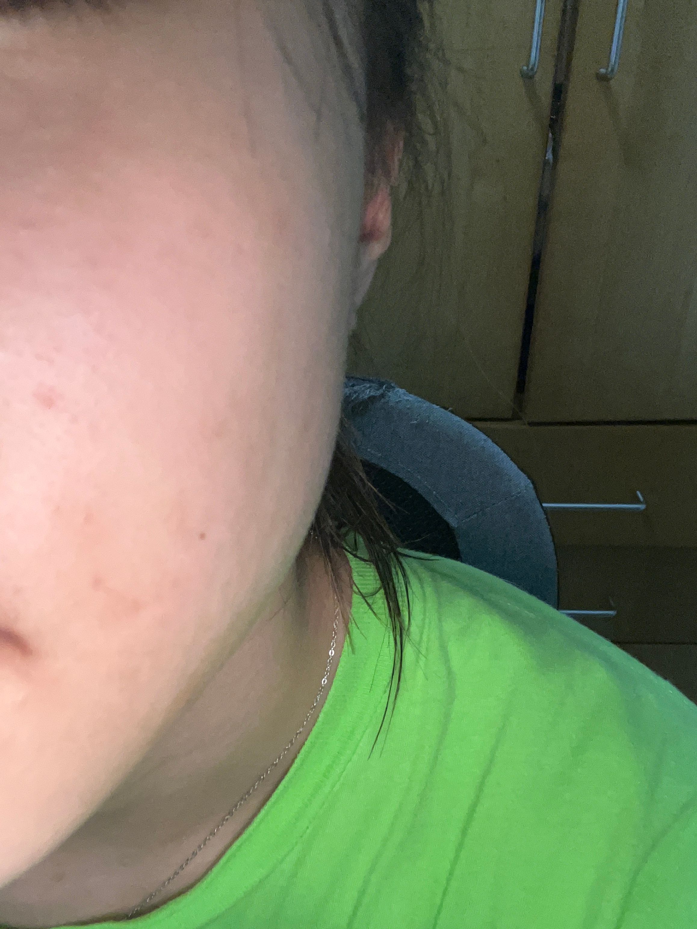 Cetaphil 積雪草舒敏平衡健膚水 真實評價/實測照片 bysuk****************com 2