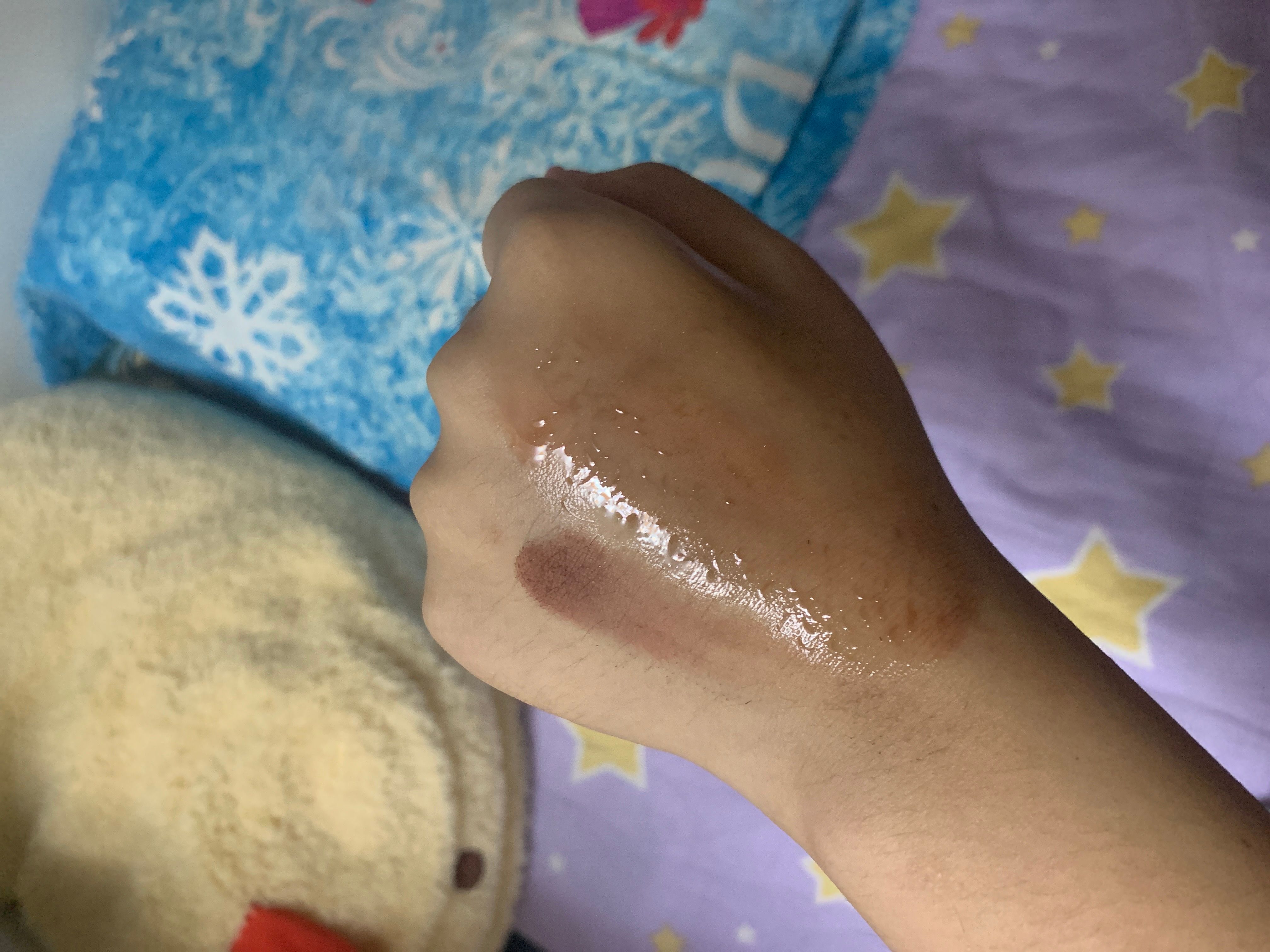 ANUA 魚腥草溶解黑頭粉刺清毛孔卸妝油  真實評價/實測照片 byh*l 1