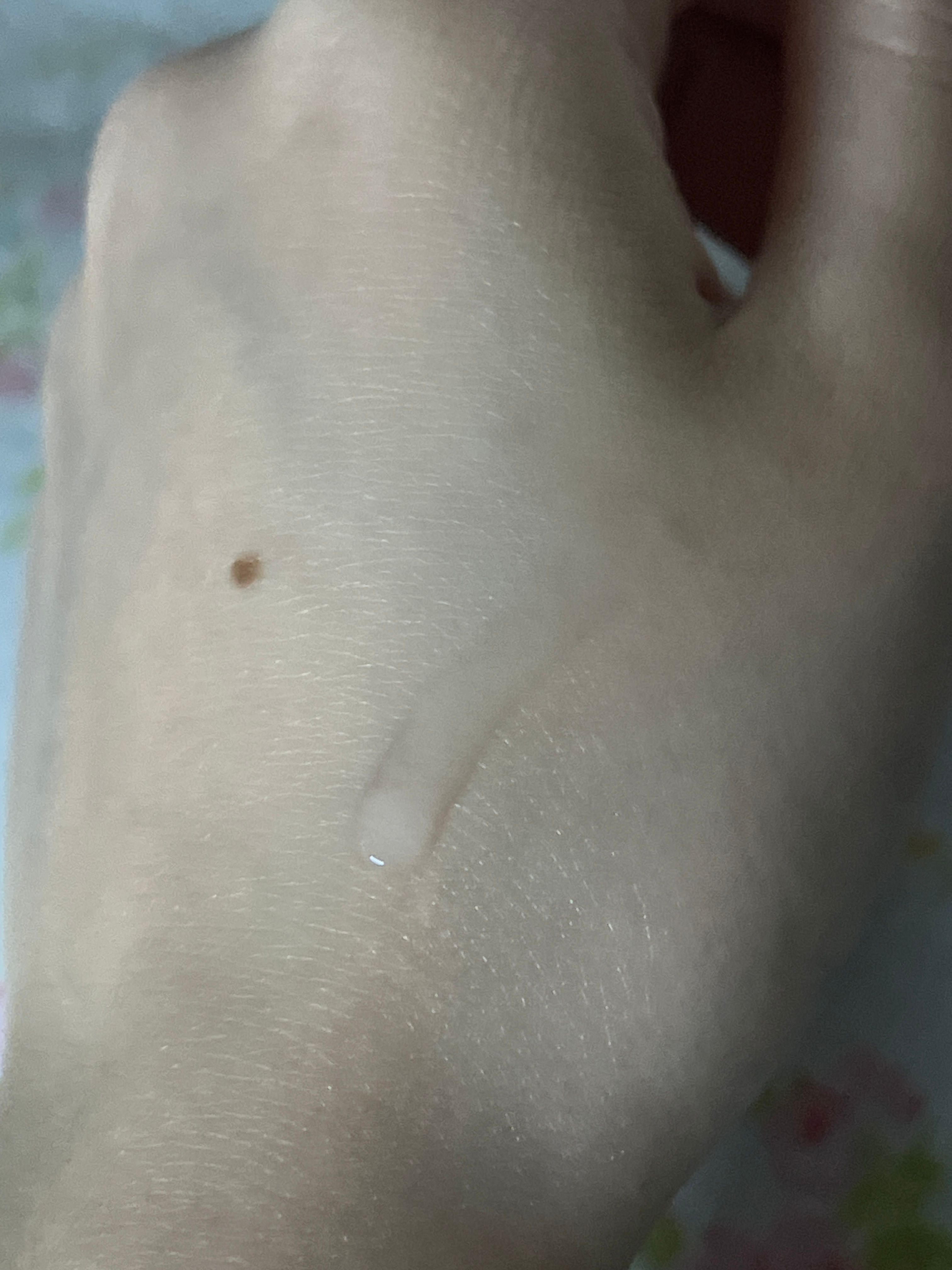 SHISEIDO VITAL-PERFECTION 全效美白抗紋滋潤健膚水 真實評價/用後感 byCry******ang 1 SHISEIDO VITAL-PERFECTION 全效美白抗紋滋潤健膚水 真實評價/實測照片 byCry******ang 1