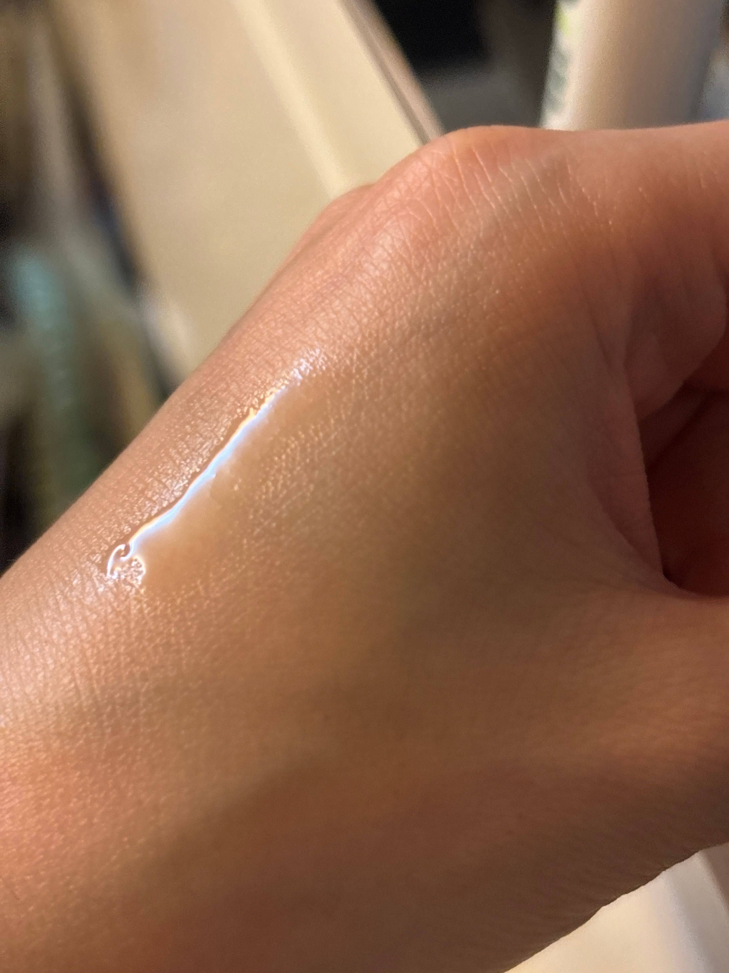 曼秀雷敦 Mentholatum 樂膚潔強效暗瘡護理精華 真實評價/用後感 bykah*************com 1 曼秀雷敦 Mentholatum 樂膚潔強效暗瘡護理精華 真實評價/實測照片 bykah*************com 1