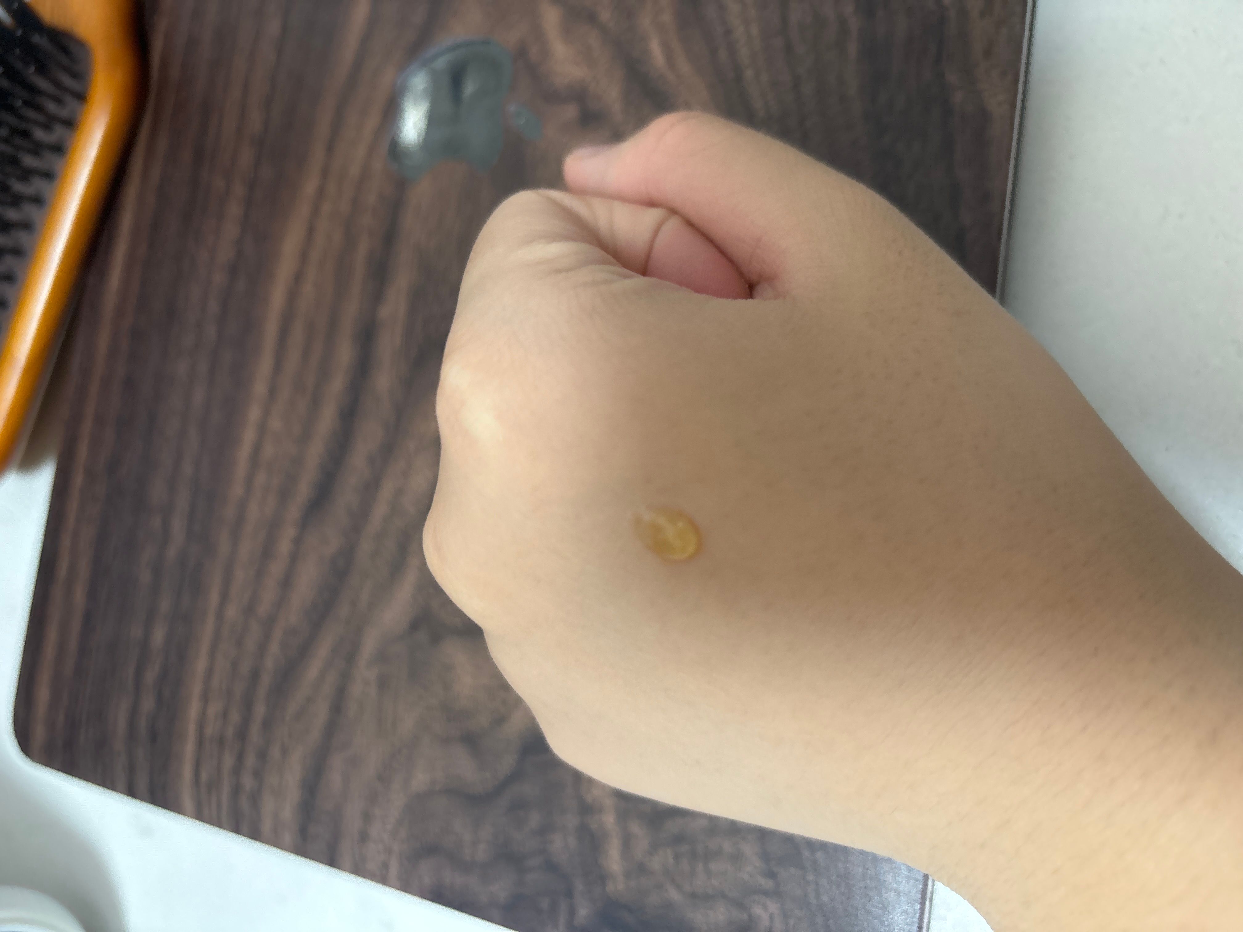 The Ordinary 咖啡因眼部去腫去黑色素精華 真實評價/用後感 byMat******l19 1 The Ordinary 咖啡因眼部去腫去黑色素精華 真實評價/實測照片 byMat******l19 1