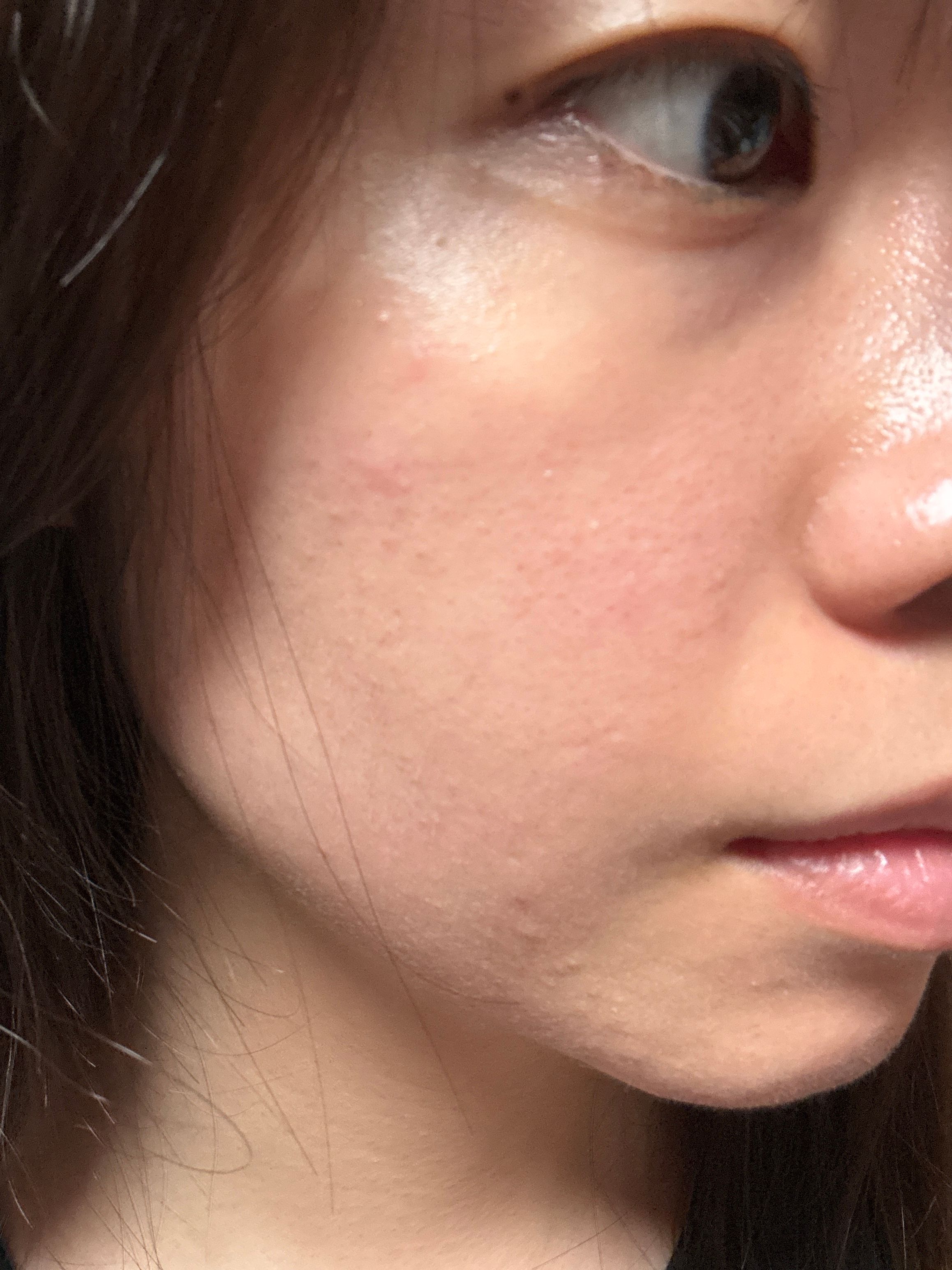 AHC 醫美科妍水光導入玻尿酸精華 真實評價/實測照片 byCai******han 1