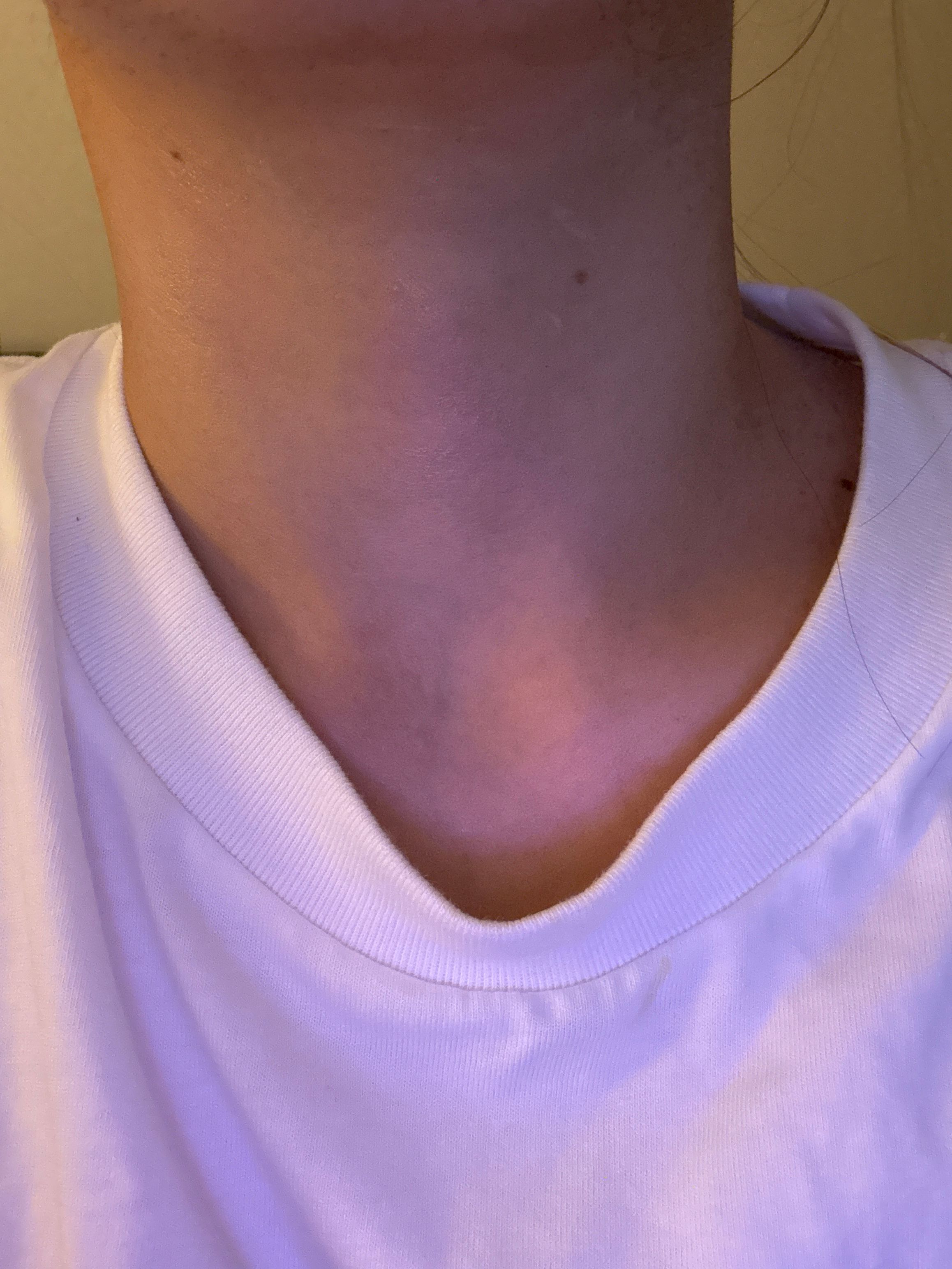  小熨斗緊緻頸紋殺手頸霜 真實評價/實測照片 byCyn******han 1