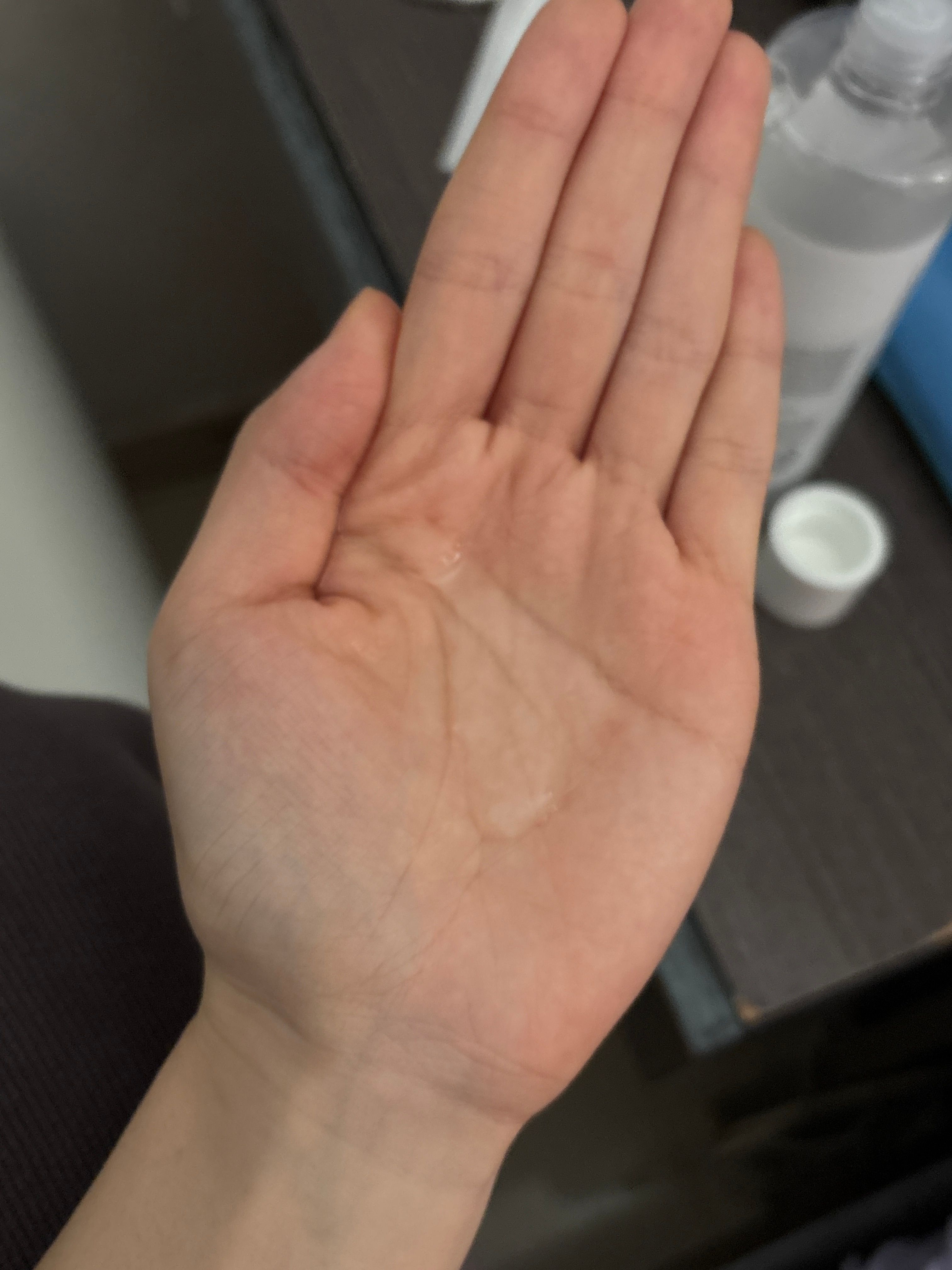ANUA 77% 魚腥草爽膚水 (77%魚腥草舒緩鎮靜保濕爽膚水) 真實評價/用後感 byfan****************com 1 ANUA 77% 魚腥草爽膚水 (77%魚腥草舒緩鎮靜保濕爽膚水) 真實評價/實測照片 byfan****************com 1