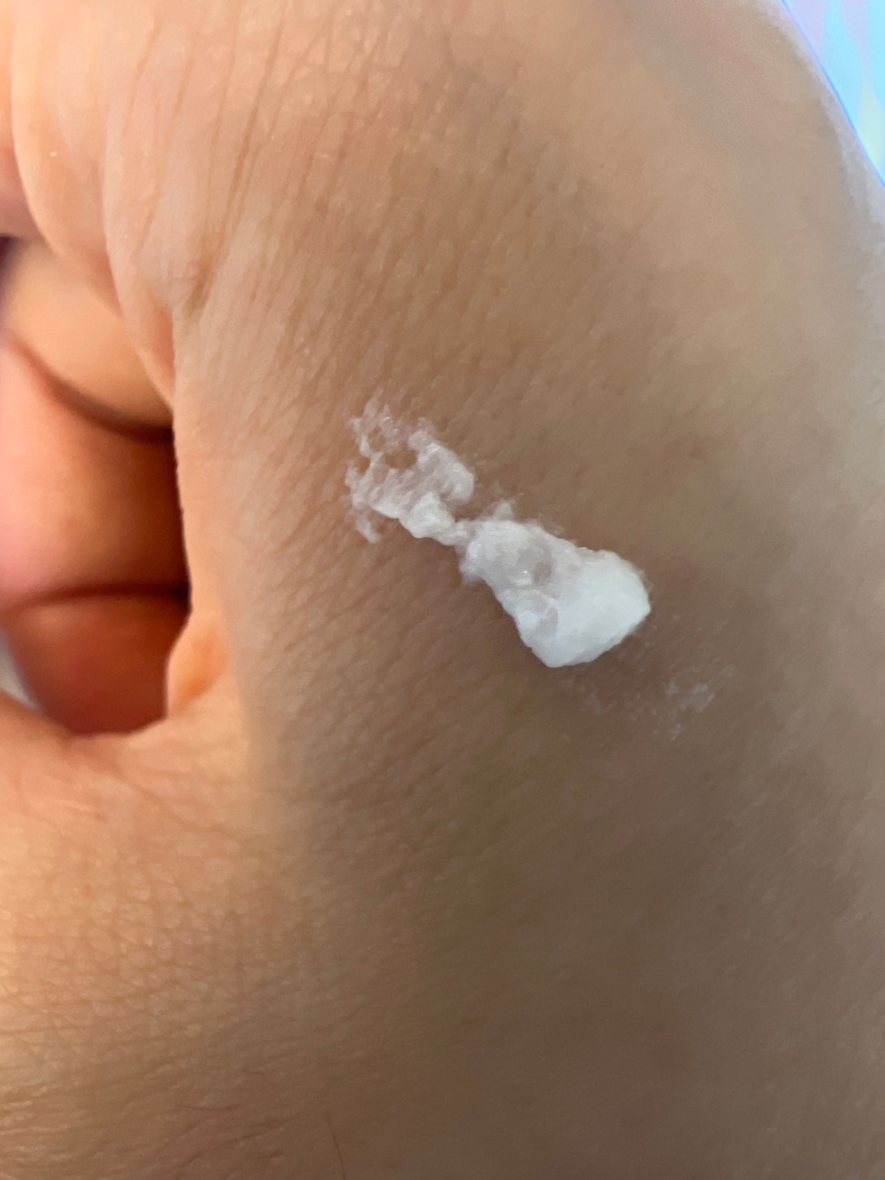 Oronine 娥羅納英 美白精華H軟膏 真實評價/實測照片 byIn**ni 1