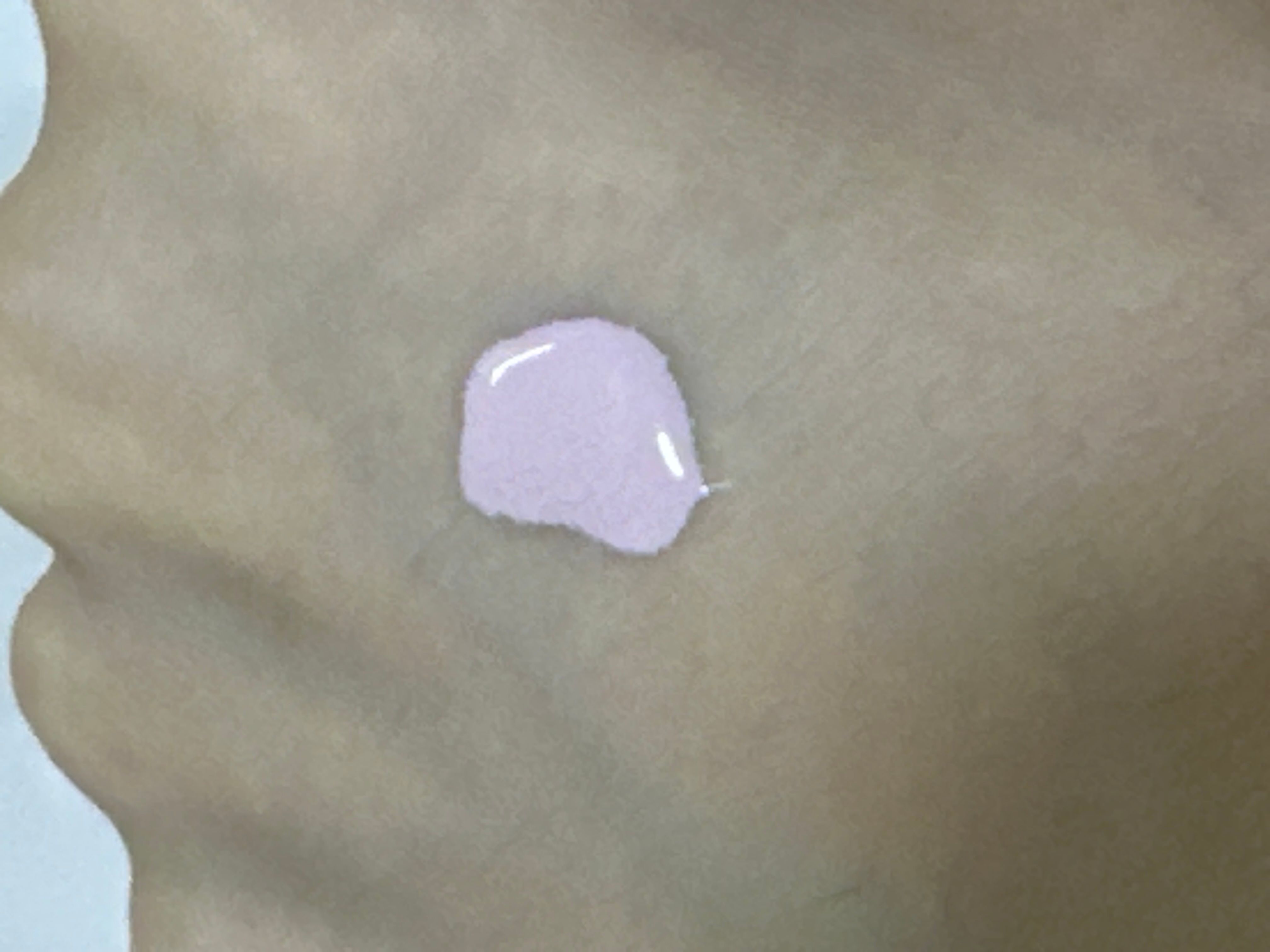 Dewytree 自顏源露爐甘石強效祛痘消炎粉液 真實評價/實測照片 byA***2 1