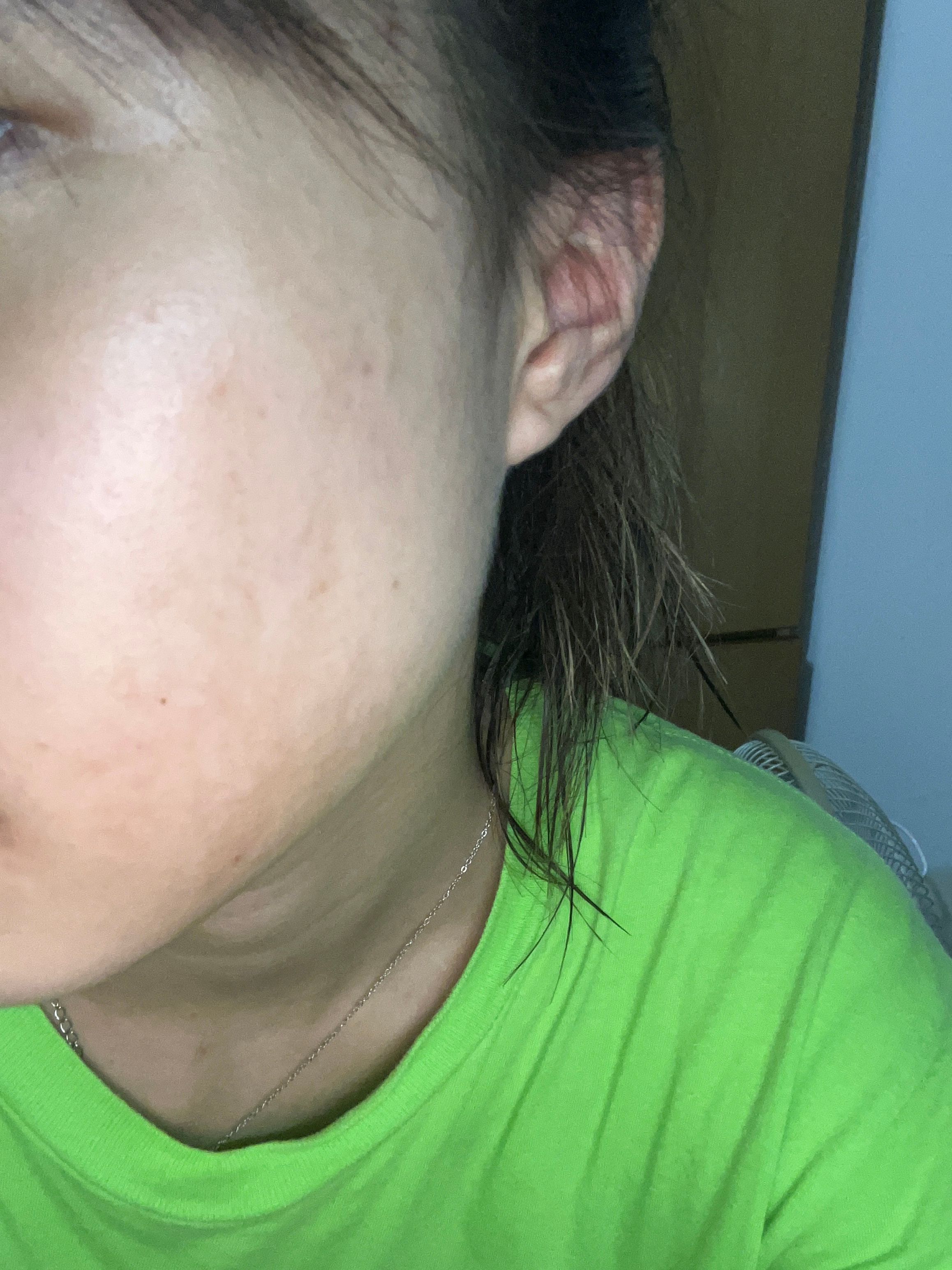 Cetaphil 積雪草舒敏平衡健膚水 真實評價/實測照片 bysuk****************com 1