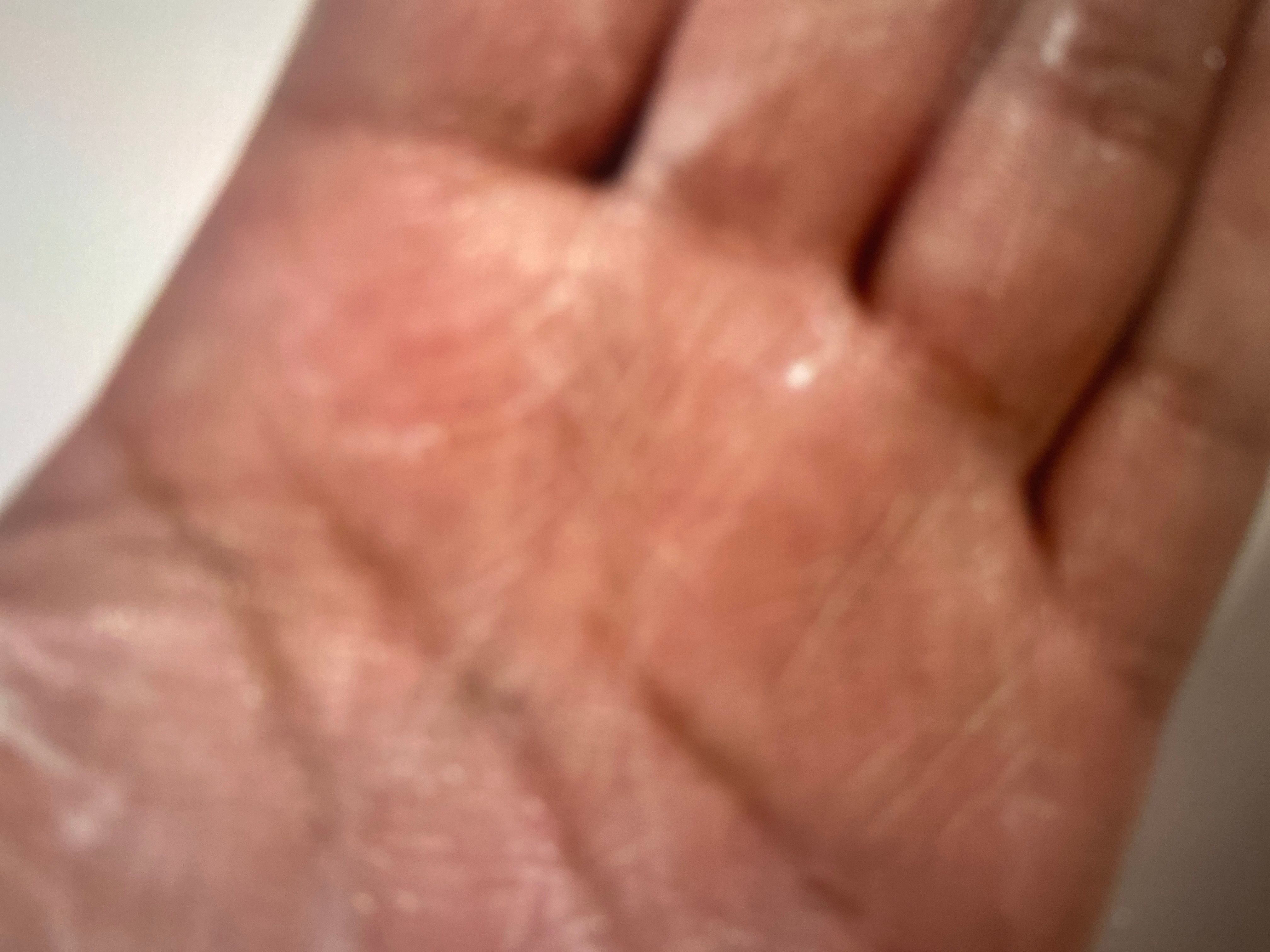 First Aid Beauty 敏感肌洗面乳 真實評價/用後感 bykit*****************com 1 First Aid Beauty 敏感肌洗面乳 真實評價/實測照片 bykit*****************com 1