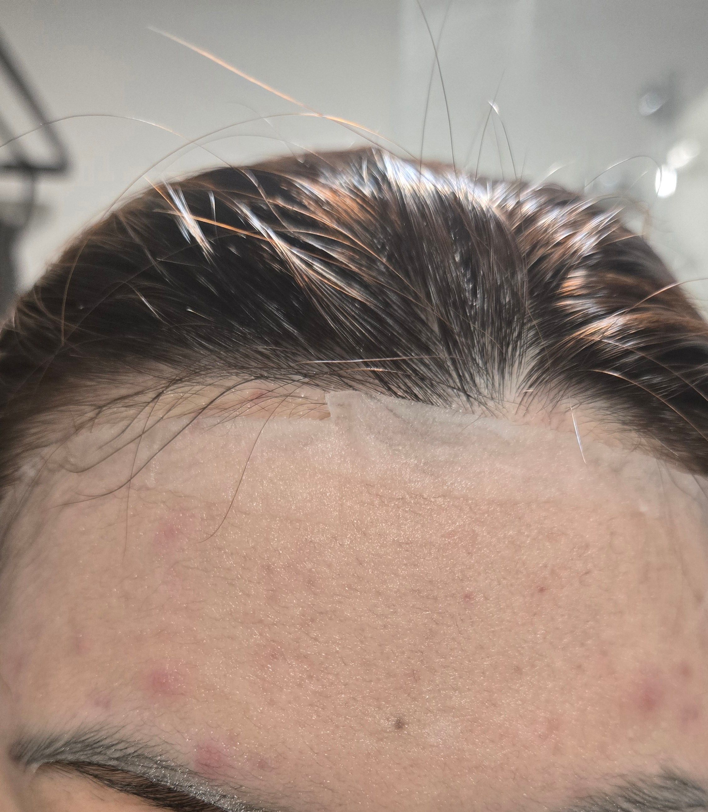 Bring Green 茶樹積雪草袪痘修護面膜 真實評價/實測照片 byEd**Be 1