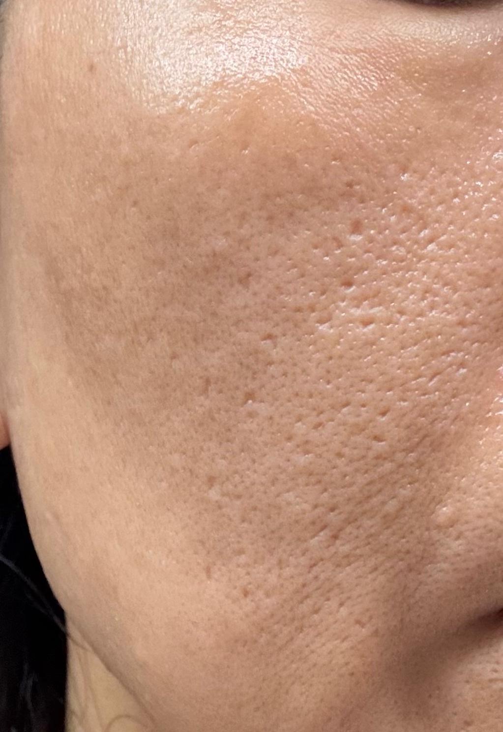 Sasatinnie 第三代升級版全效水潤透光面膜 真實評價/實測照片 byV ***ng 2