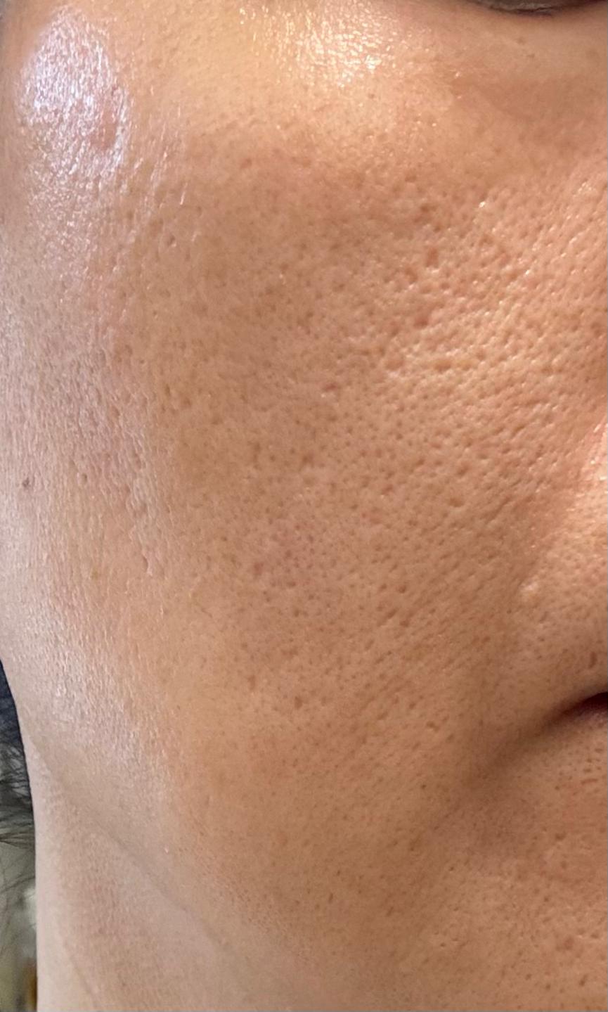 Sasatinnie 第三代升級版全效水潤透光面膜 真實評價/實測照片 byV ***ng 1