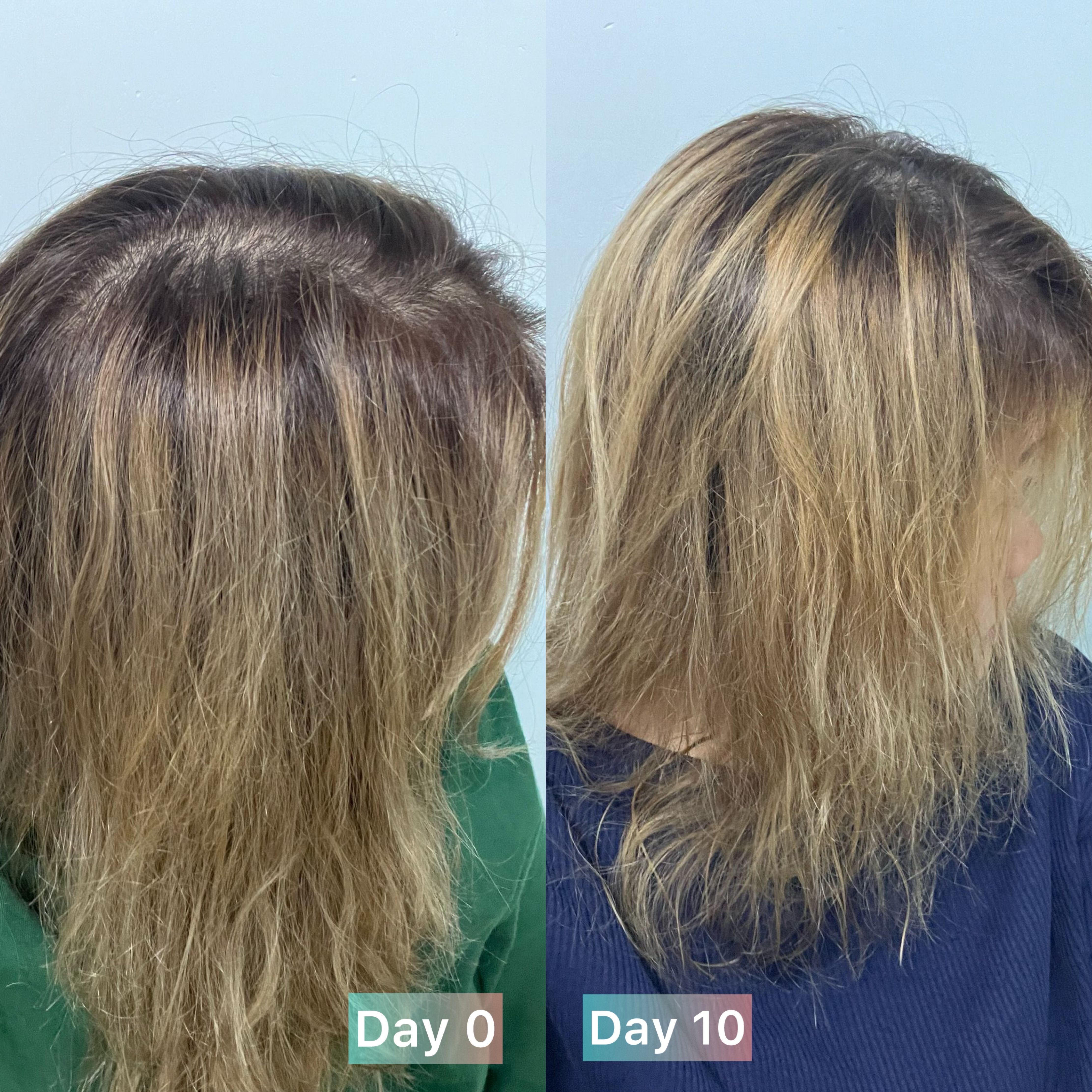 Vita Green 維特健靈 維新烏絲納米激活生髮洗髮精華露 真實評價/實測照片 byhaz*****************.hk 2