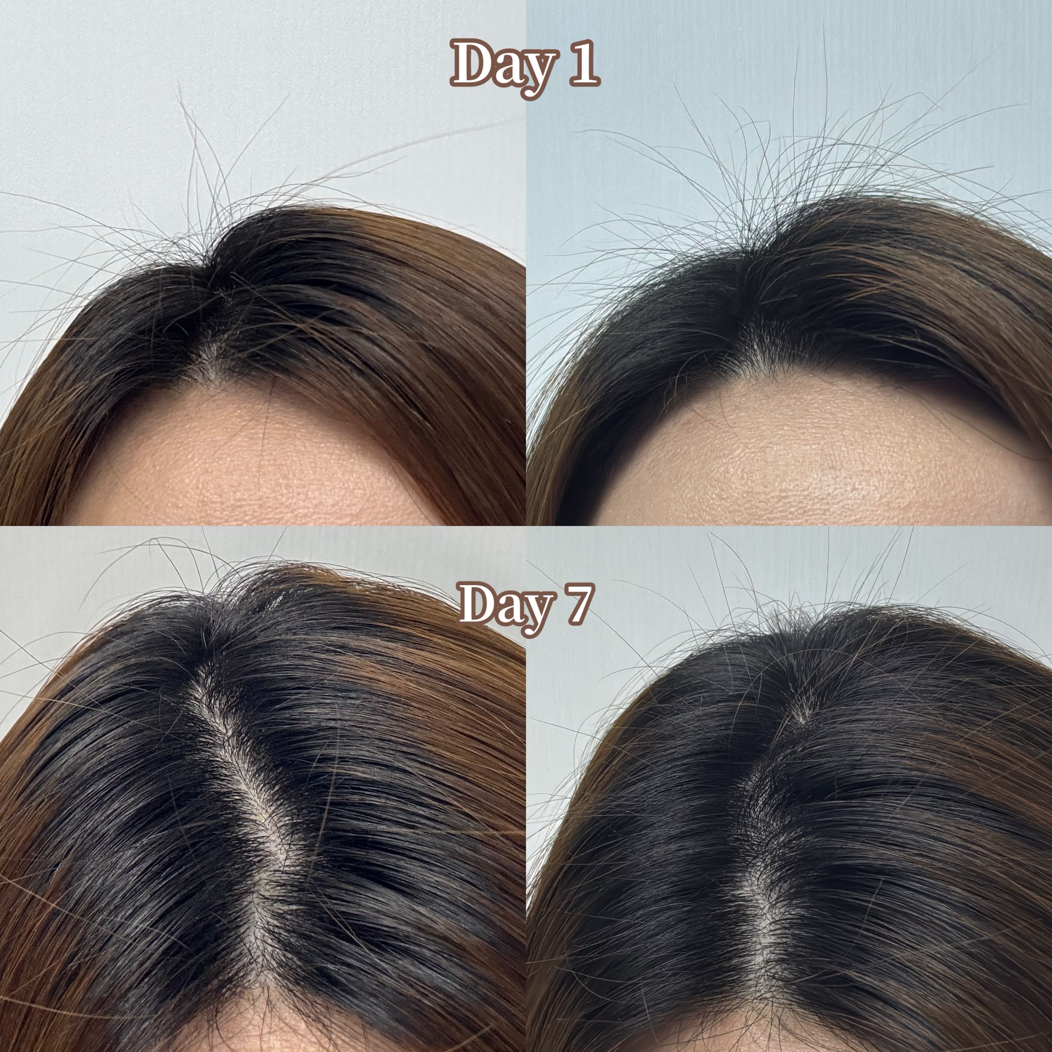 潘婷 Pantene 豐盈防脫頭皮精華 真實評價/用後感 bye.j*************com 1 潘婷 Pantene 豐盈防脫頭皮精華 真實評價/實測照片 bye.j*************com 1