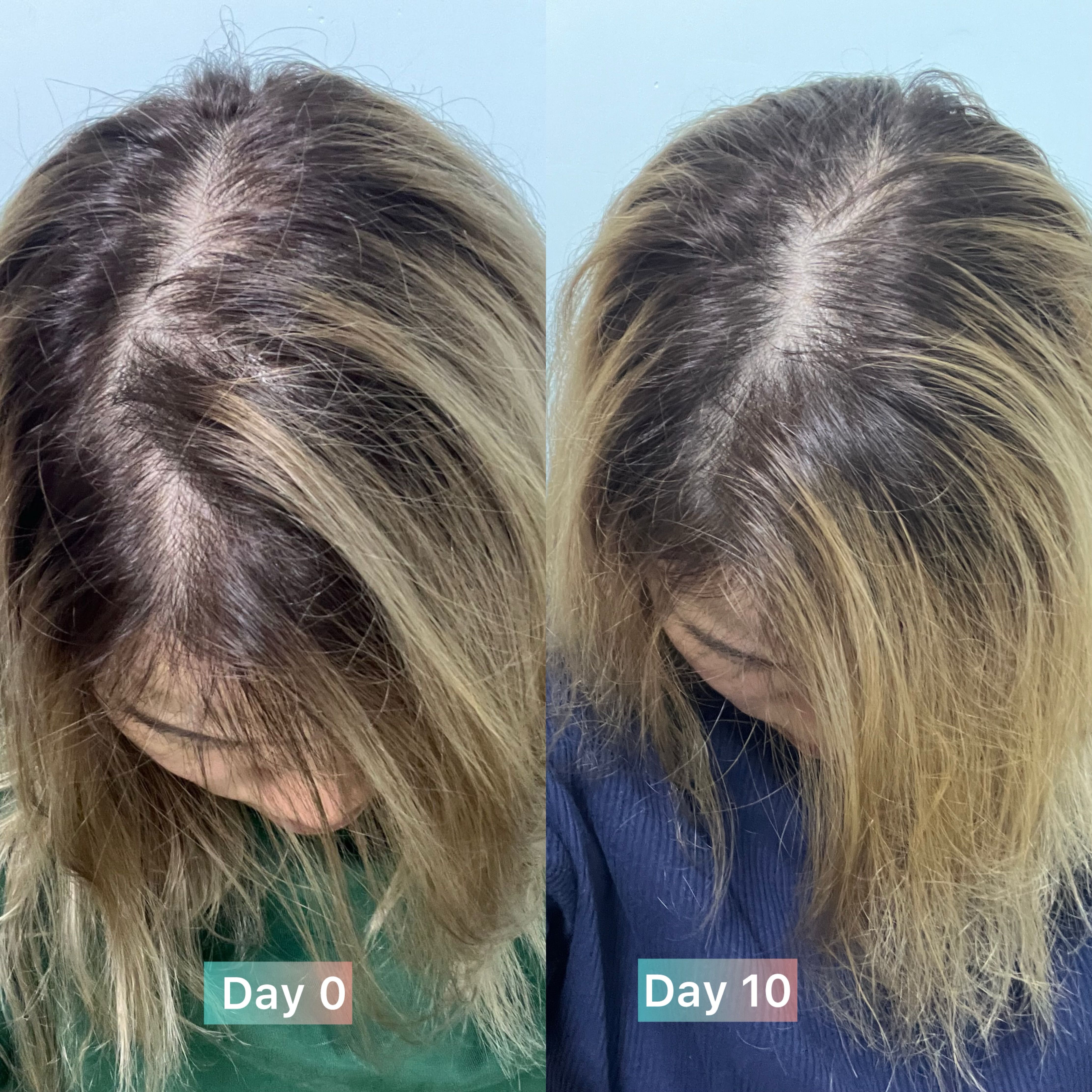 Vita Green 維特健靈 維新烏絲納米激活生髮洗髮精華露 真實評價/實測照片 byhaz*****************.hk 1